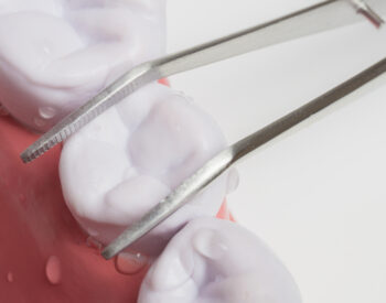 Orthodontic Exposures